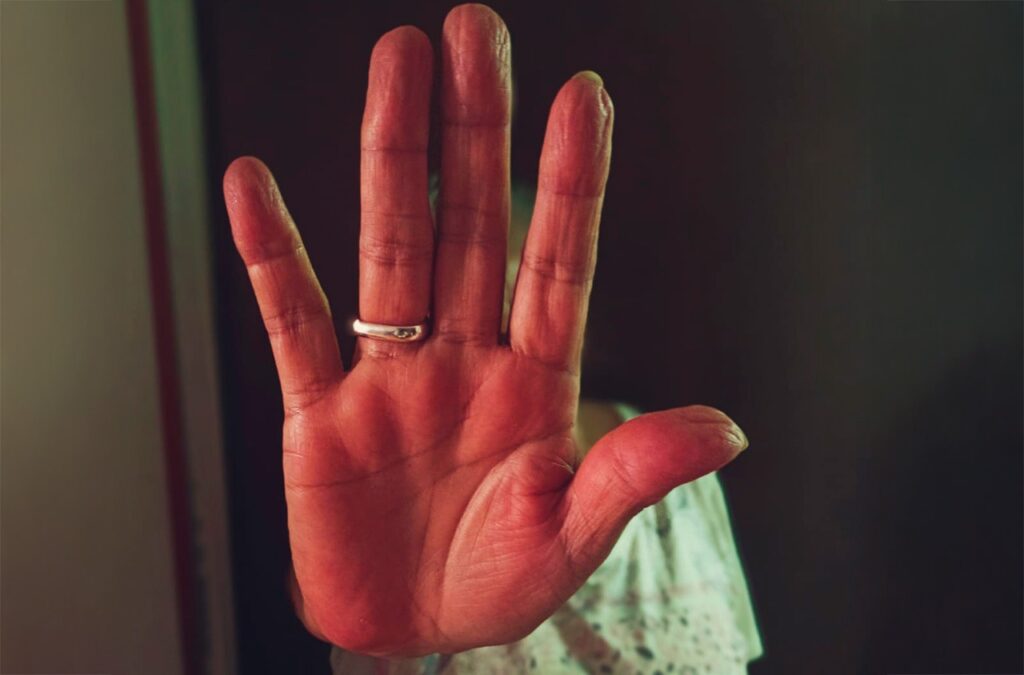 Violencia contra las mujeres en propiedad horizontal